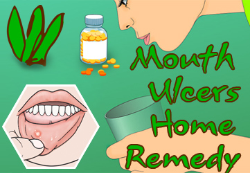 home remedies to get rid of mouth ulcers